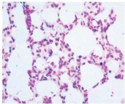 Immunohistochemistry-Paraffin: TACS-XL In Situ Apoptosis Kit [HRP] [NB4828-30-BK] - TACS-XL In Situ Apoptosis Kit [TACS Blue Label] [NB4828-30-BK] - Mouse lung parenchyma tissue was fixed and embedded in paraffin. Five micron sections were prepared and immobilized on slides. The tissue was labeled as describe in the protocol (NB4828-30-BK) and analyzed by light microscopy for DNA fragmentation indicated by the blue stained cells. Data was provided courtesy of F. D'Agostini, University of Genova Via A. Pastore, Genova, Italy.